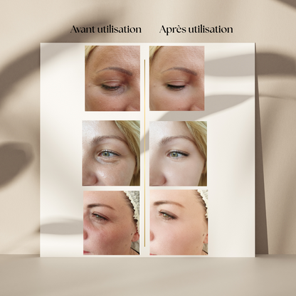 Stick Contour des Yeux à l’Essence d’Escargot – Anti-Cernes & Anti-Âge