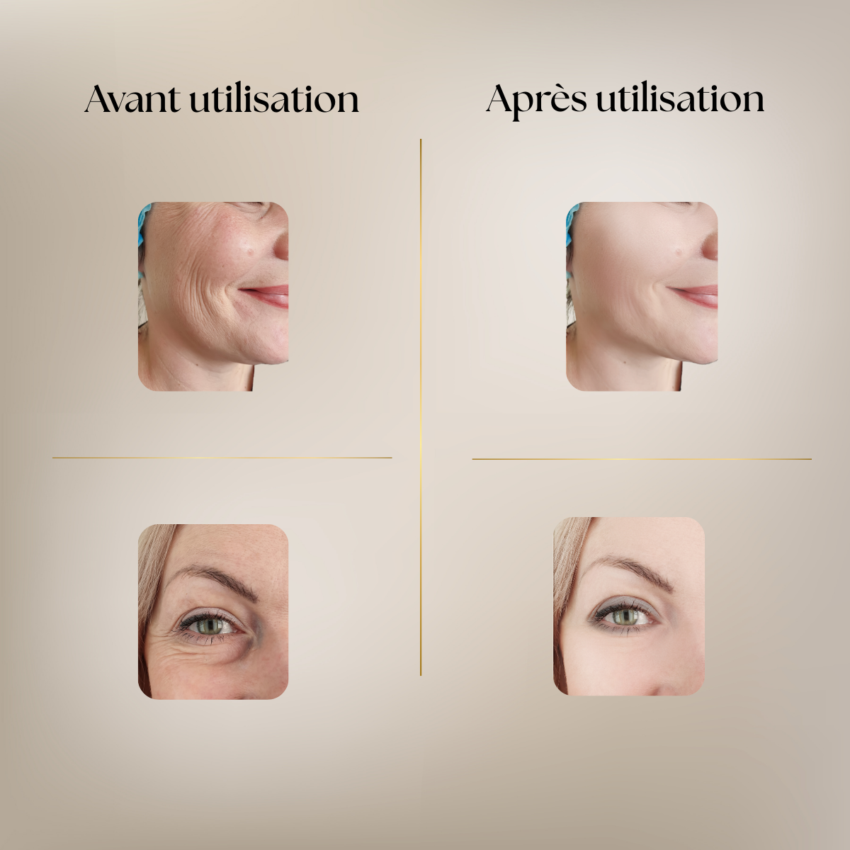 Appareil de Beauté Visage & Cou – Anti-Âge, Lifting & Éclat Instantané