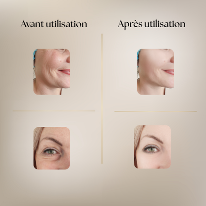 Appareil de Beauté Visage & Cou – Anti-Âge, Lifting & Éclat Instantané